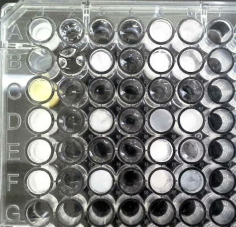 Photo of the plate after the sample experiment | Download Scientific Diagram