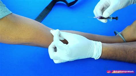 How To Do Venous Blood Sampling (Venipuncture) : Step-by-Step Description of Procedure ...