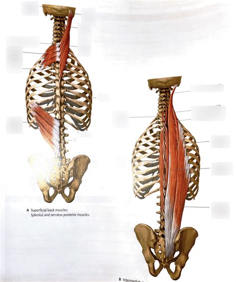 erector spinae muscles Diagram | Quizlet