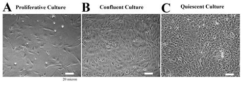 Typical MEF culture during proliferative, confluent and quiescent states. | Download Scientific ...