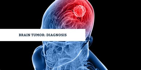 Brain Tumor Diagnosis: How to Test, Diagnose and Detect Brain Cancer