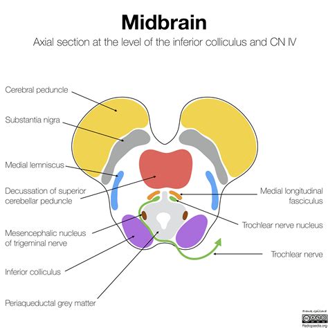 Radiopaedia - Drawing Midbrain at level of inferior colliculus and ...