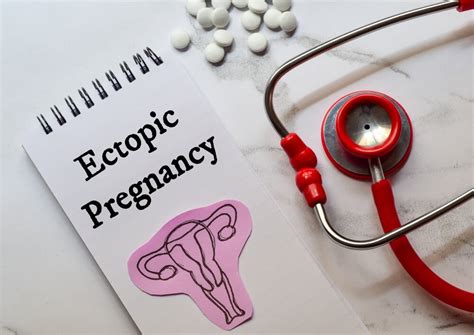 Ectopic Pregnancy: Causes, Symptoms, Diagnosis, and Treatment