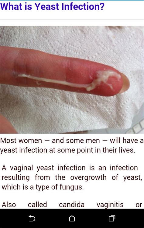 Yeast Infection APK for Android Download