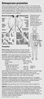 Osteoporosis prevention – PointFinder Health Infographics