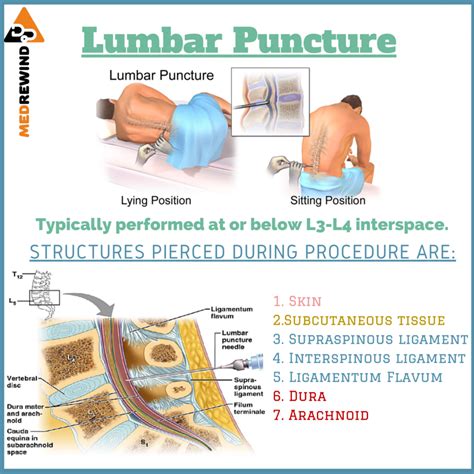 Lumbar Puncture Layers