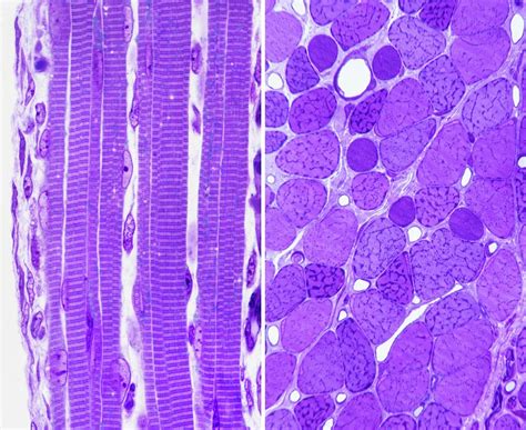 Skeletal Muscle