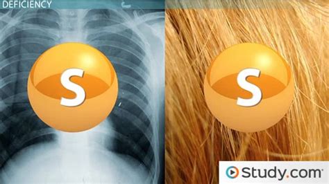 Sulfur Deficiency & Toxicity Symptoms - Lesson | Study.com