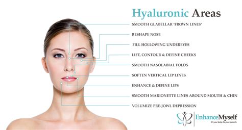 Cost of Hyaluronic Acid Dermal Fillers - Types, Benefits, Results