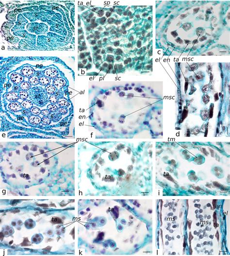 Early stages of androecium development in Helianthus maximilianii :a ...