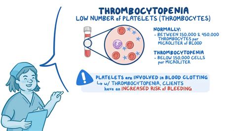 Thrombocytopenia: Nursing - Osmosis Video Library