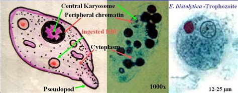 Entamoeba histolytica trophozoite | Medical Laboratories