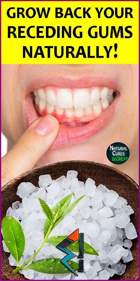 How To Treat Receding Gums at Home - Home Remedies for Gum Disease How To Treat Receding Gums at ...