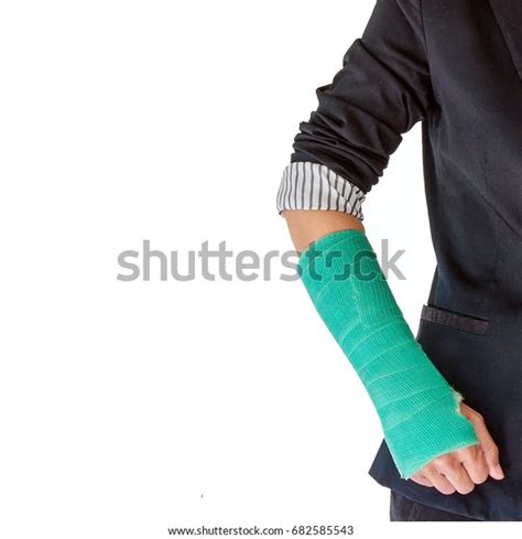 Closeup Broken Arm Cast Isolated On Stock Photo 682585543 | Shutterstock