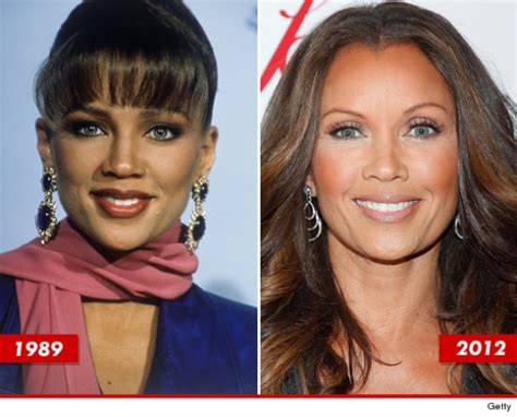 Vanessa Williams Plastic Surgery Before and After Botox and Nose Job