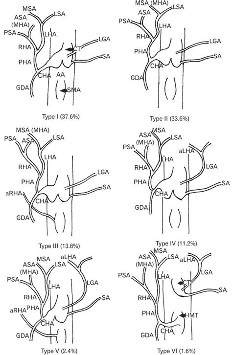 Hepatic Artery Branches