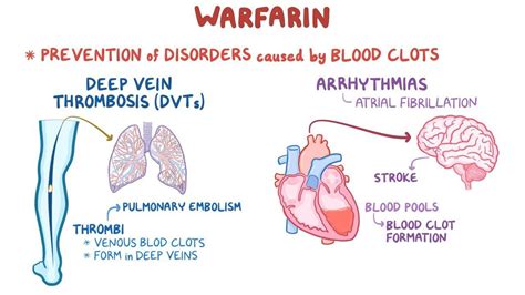 Anticoagulants: Warfarin - Osmosis