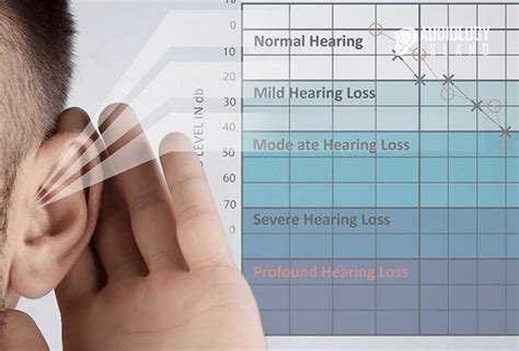 What is an Audiogram and How to Read it - Audiology Island