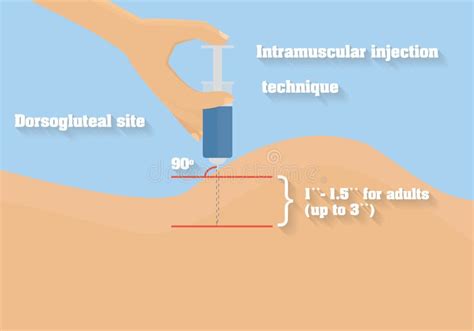 Intramuscular Injection Technique Vector Illustration. Technique Of Intramuscular Route Of ...