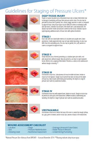 Pressure Ulcer Staging | Hill-Rom Clinical Resource Center