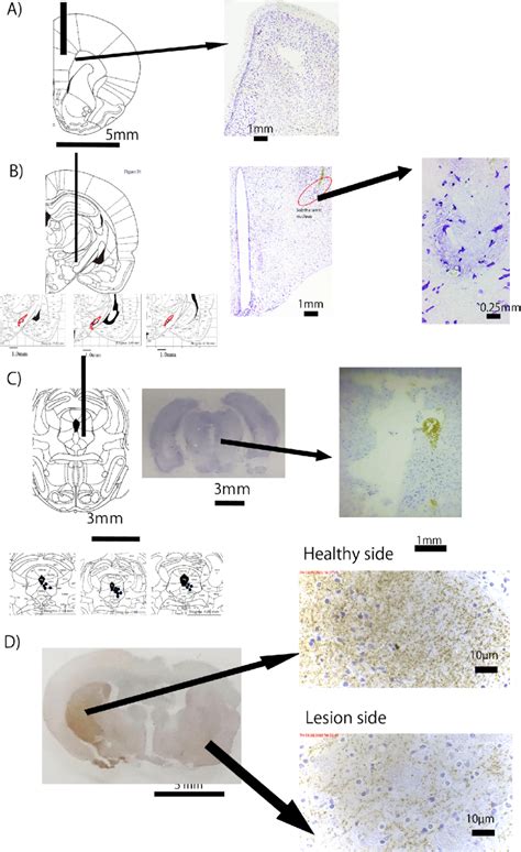 Photographs of cresyl violet-stained coronal rat brain sections of the ...