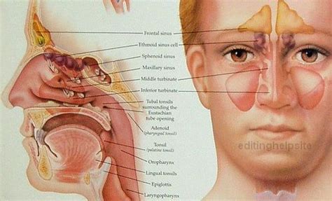 Sinus Infection (Sinusitis): Signs, Symptoms & Treatment