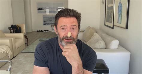 With sunny days ahead, Hugh Jackman has tips to avoid skin cancer - CBS Philadelphia