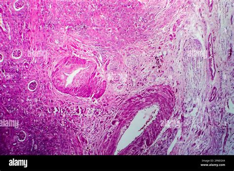Autoimmune microscopy hi-res stock photography and images - Alamy