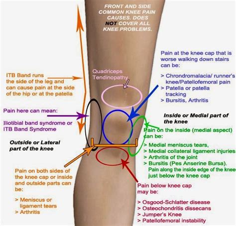 Types of Knee Pain