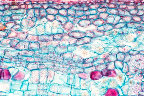 Collenchyma Under Microscope