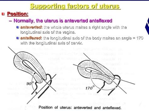 Retroverted retroflexed uterus &uterine inversion