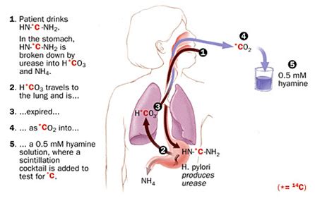 Which of more reliable diagnostic technique for detection of H pylori ...