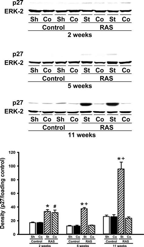 Expression of the cell cycle inhibitor p27 is transiently increased in ...