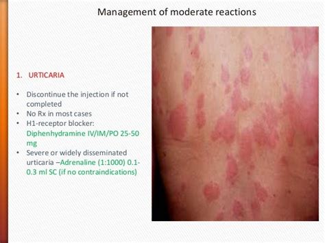 Contrast reactions