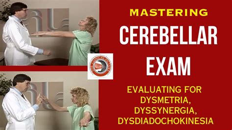 Mastering The Cerebellar Exam - Evaluating for Dysmetria, Dyssynergia ...