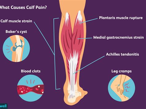 Right Leg Pain Behind Knee