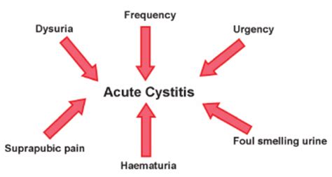 Common presenting symptoms associated with acute cystitis. Typically ...