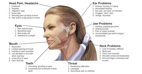 Jaw R E S E T | Headache behind eyes, Headache, Temporomandibular joint