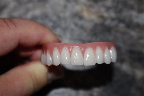 Upper Denture / Horseshoe Upper Dentures /the Denture is Real - Etsy ...