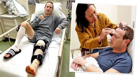 Mark Zuckerberg in hospital after jiu-jitsu accident