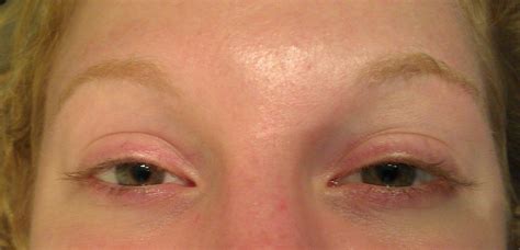 Eyelash Tint before and after pictures