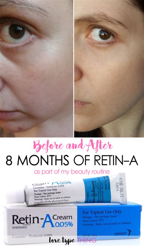 Before and After Retin-A - 8 months results | Skin care, Skin care tips, Anti aging skin products