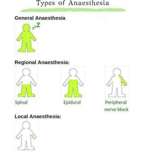 Types of Anesthesia - MEDizzy