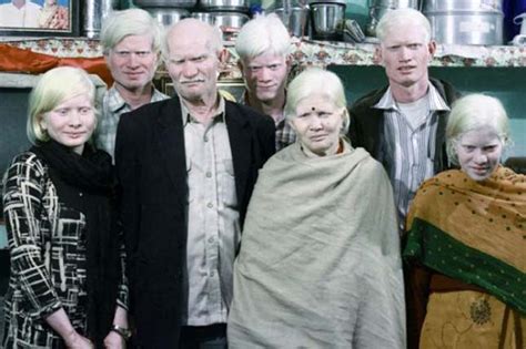 The Largest Albino Family in the World Lives in India - ONEjive.com