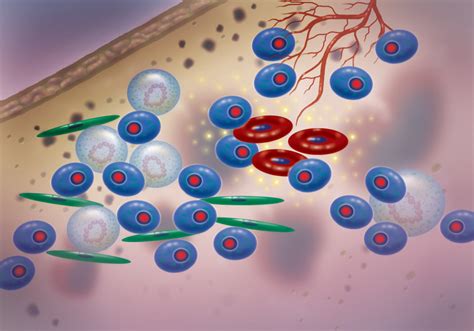 What is a Bone Marrow Biopsy and How Does it Work?