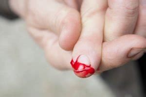 Bleeding Cuts First Aid: First Aid and How to Stop Bleeding | Medlink Healthcare Group