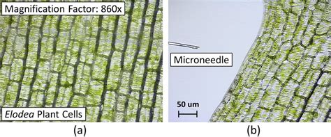 Elodea Cells Under A Microscope