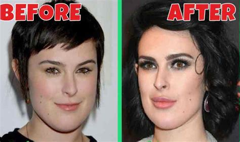 Rumer Willis' Plastic Surgery is Making Rounds on the Internet