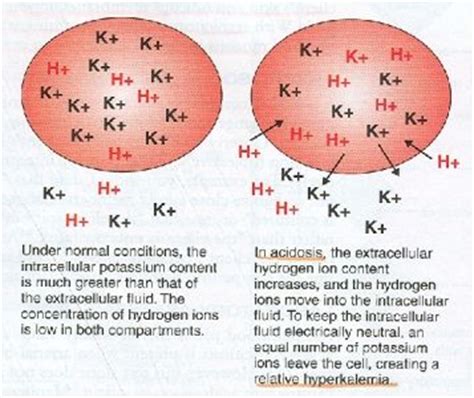 Pin by Connie McGee on Nursing (Acidosis, Alkalosis) | Pinterest