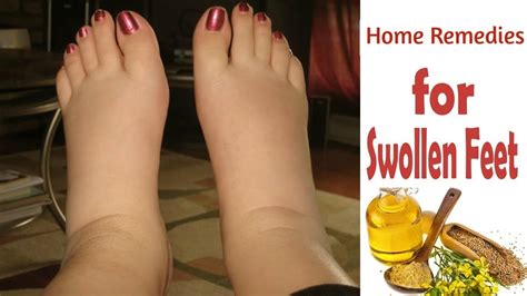 Top 5 Effective Home Remedies For Swollen Feet And Ankle Morpheme ...